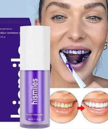 Hismile V34 Purple Whitening Toothpaste tube with purple cap, showing bright white teeth illustration, imagecaption=Hismile V34 Purple Whitening Toothpaste – effective stain removal and brightening for a confident smile