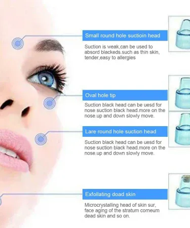 Cell Operated Blackhead Removal Machine Derma Suction 4‑in‑1 Black Head Remover – portable skin vacuum tool for home use