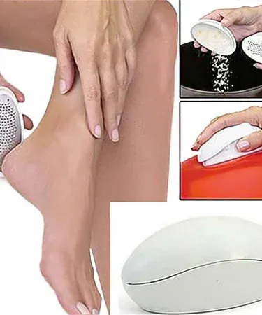 Ped Egg Callus Foot Dead Skin Remover Pedicure Ultimate Foot File for smooth beautiful feet care