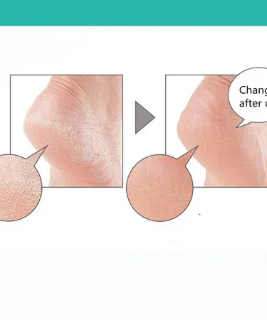 1 pair silicone heel pads soft high‑elastic breathable foot protector, imagecaption=Silicone Heel Pads – Comfortable, Reusable Heel Protectors for Men and Women,