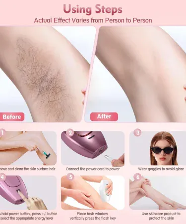 Abu Turab IPL Permanent Laser Hair Removal Handheld Device – sleek, portable, advanced IPL technology for at‑home hair removal, imagecaption=Abu Turab (أبو تراب) IPL Handheld Hair Removal Device – professional‑grade, permanent hair removal solution for face, body, and bikini area.