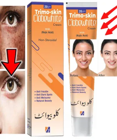 Pack of 3 Trimoskin Cream with Hand & Feet Cream and ClobeWhite for skin moisturization and freckles/spots removal