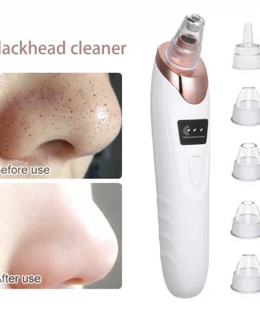 5‑in‑1‑electric‑blackhead‑acne‑oil‑remover‑vacuum‑suction‑face‑pore‑cleaner‑machine‑Khareedo‑Kharedo