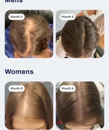 Elora Care Hair Oil bottle – premium hair nourishment oil, imagecaption=Elora Care Hair Oil – available on Khareedo & Kharedo with Check on Delivery,