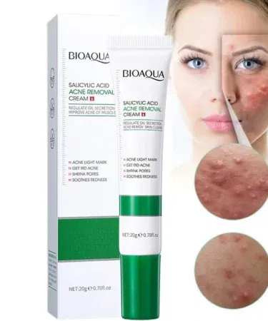 BIOAQUA Salicylic Acid Acne Cream – lightweight daily acne care cream in a 20 ml tube, showing the product packaging with clear branding.