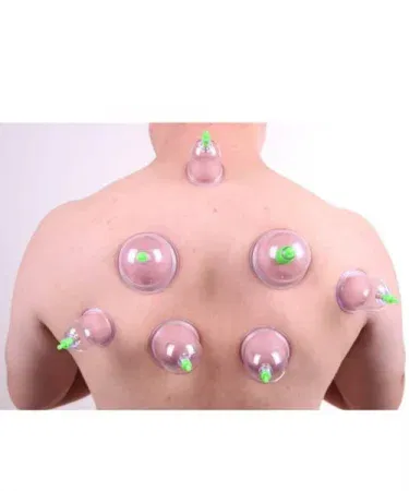 12-piece vacuum suction hijama cupping therapy set with various sized cups for body massage and pain relief