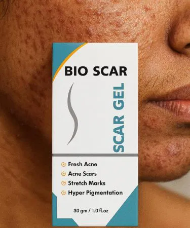 Lightweight bio scar gel 30gm for reducing scars and marks in Pakistan