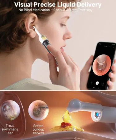Rechargeable smart wireless ear camera kit for visual ear wax removal with mobile display, sold in Pakistan.