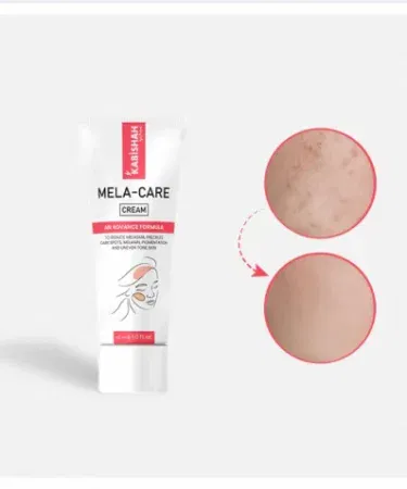 Mela Care Advanced Brightening Cream | Khareedo