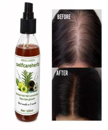 Selfcareherb Hair Growth Serum with Rosemary for all hair types, scalp application, 120ml, sold in Pakistan